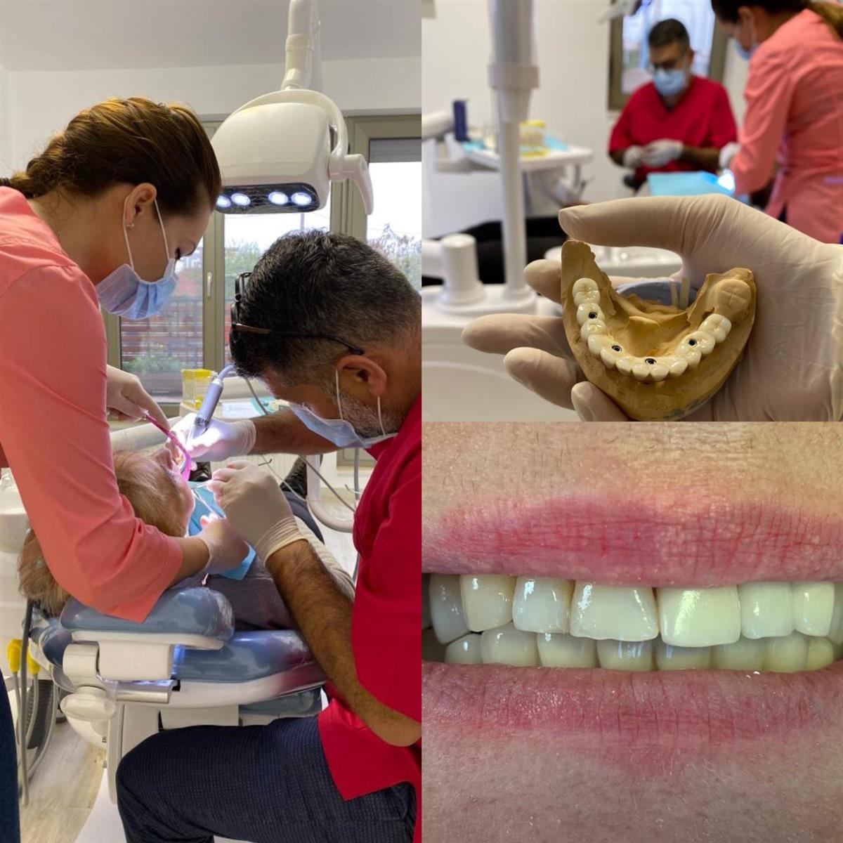 Implant Eladent
