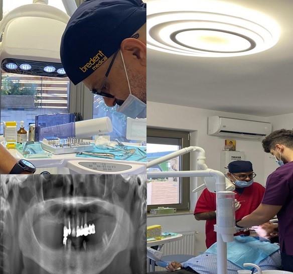 Implant Eladent
