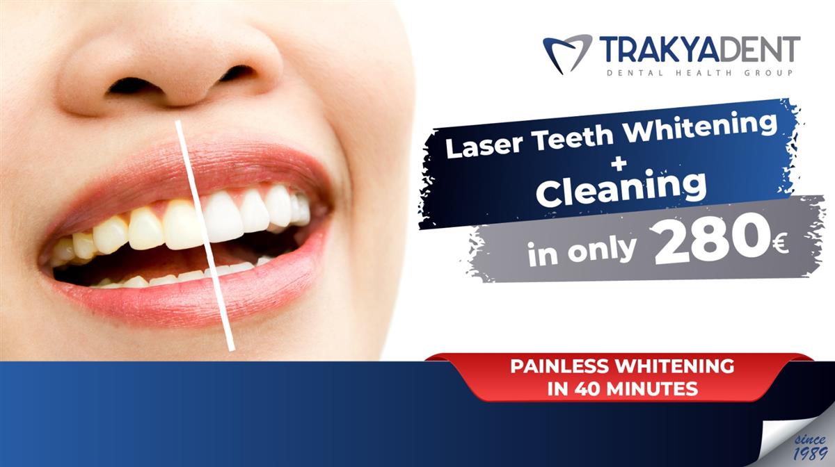 Laser Teeth Whitening and Cleaning Campaign