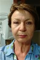 Dra. Luba, MD, Cosmetic Surgeon